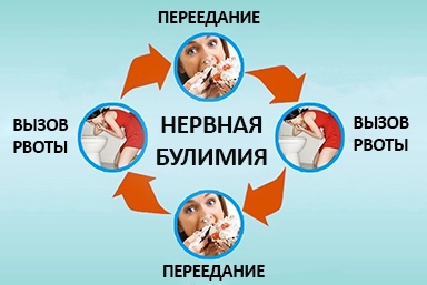 Лечение булимии в Кагальнике